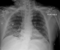 CV4Health demo GIF