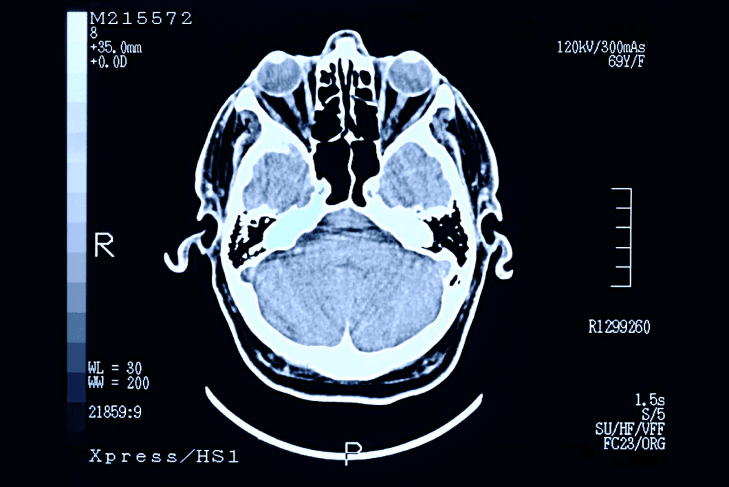 DICOM Image Example